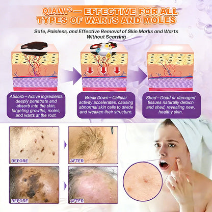 🔥LAST DAY 50% OFF - QIAWI® Biotin 10-in-1 Skin Restoration Cream